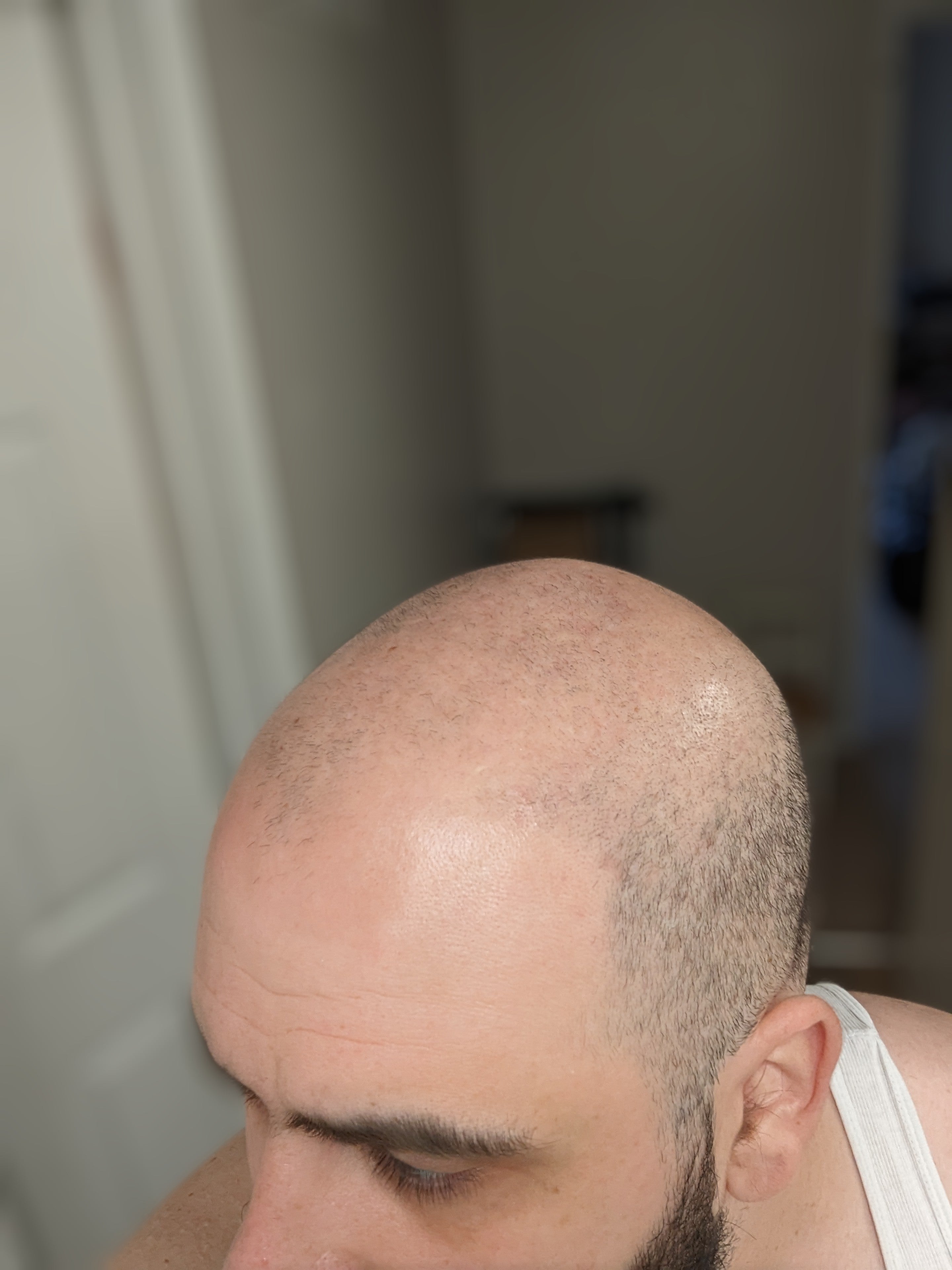 After using Samu's Bee and Flow manuka scalp left